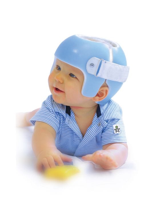 Plagiocephaly: Management of Baby Flat Head